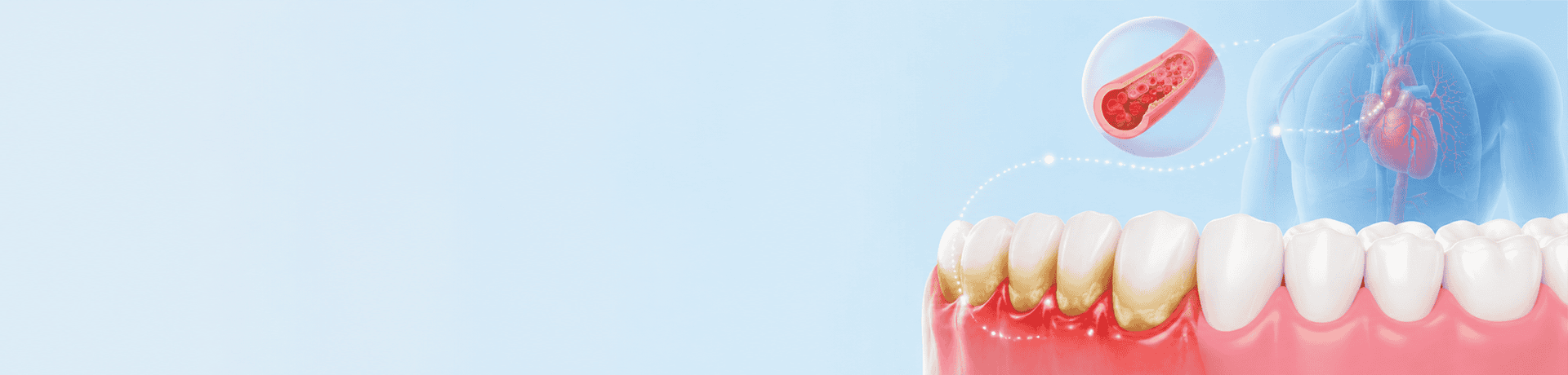 Oral Health and Systemic Disease Connection