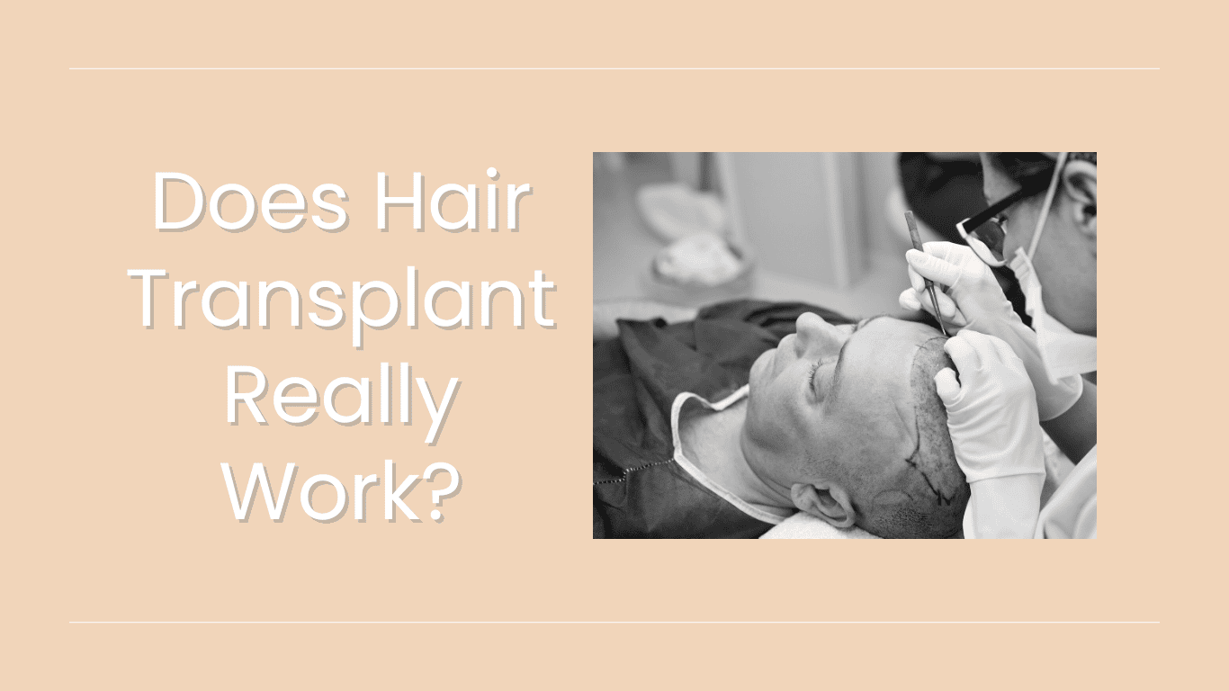 Does Hair Transplant Really Work? Complete Expert Guide from Turkey's Leading Surgeons