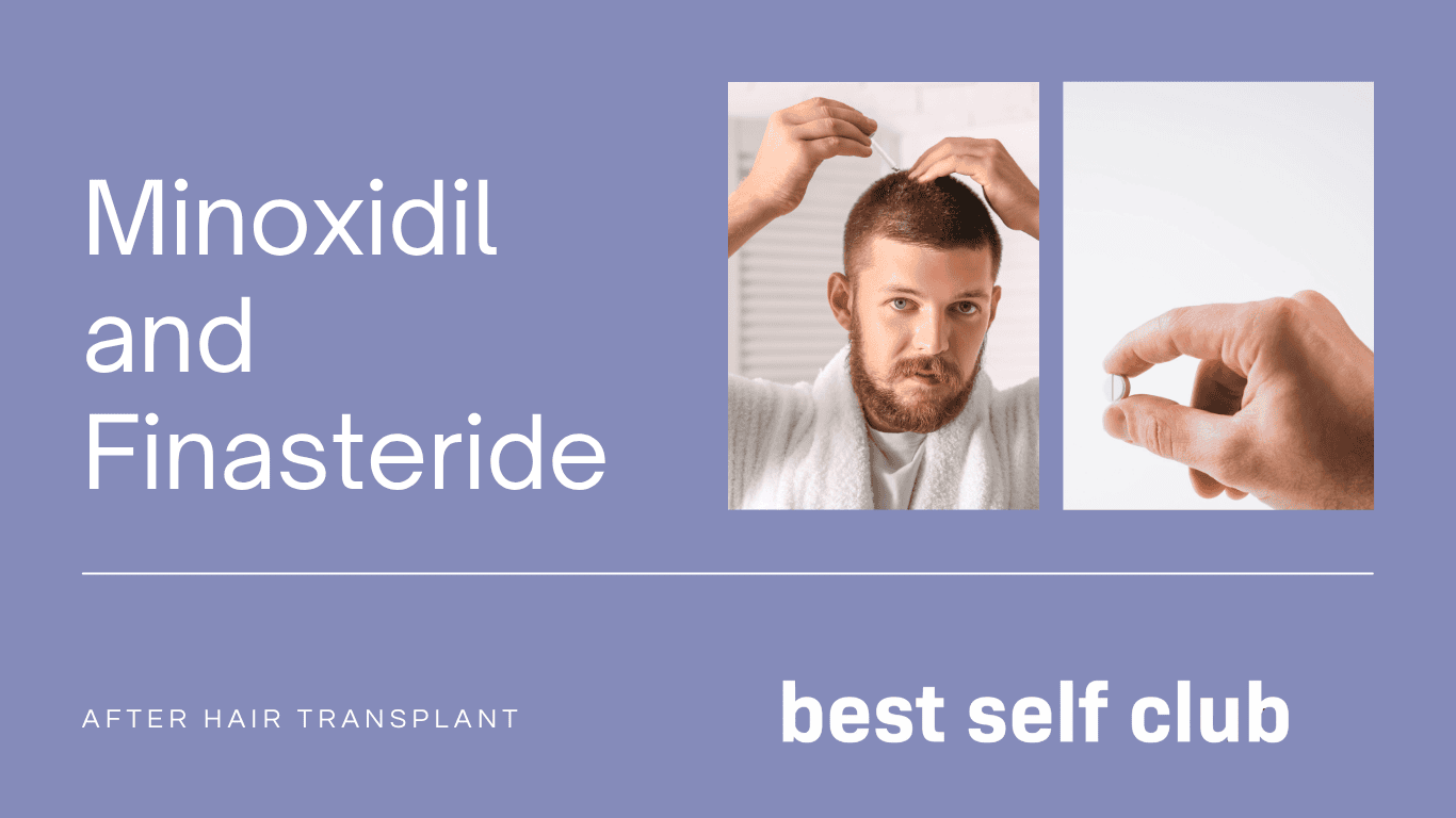 Minoxidil and Finasteride After Hair Transplant