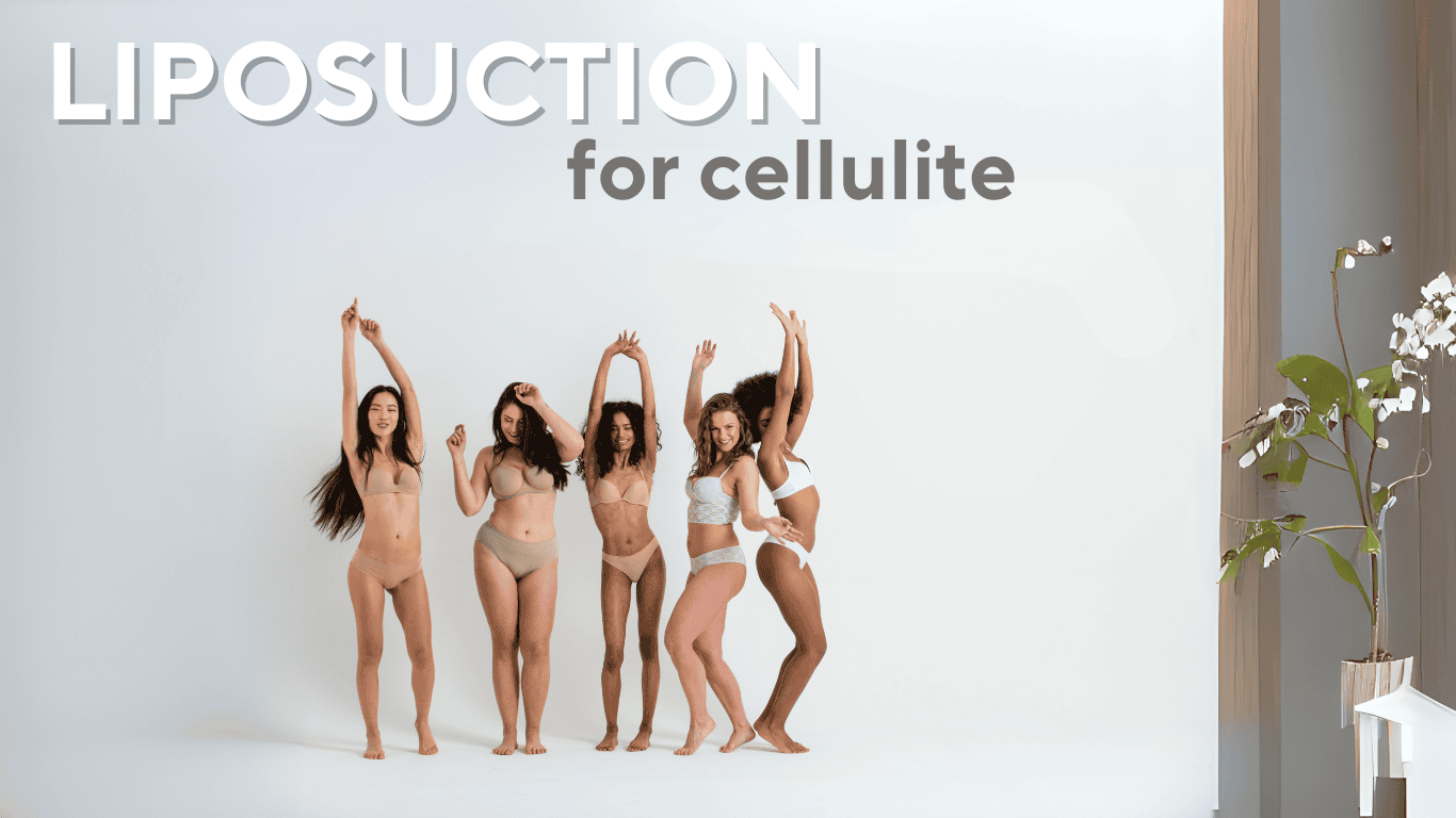 Does Liposuction Help Reduce Cellulite? | Best Self Club Turkey