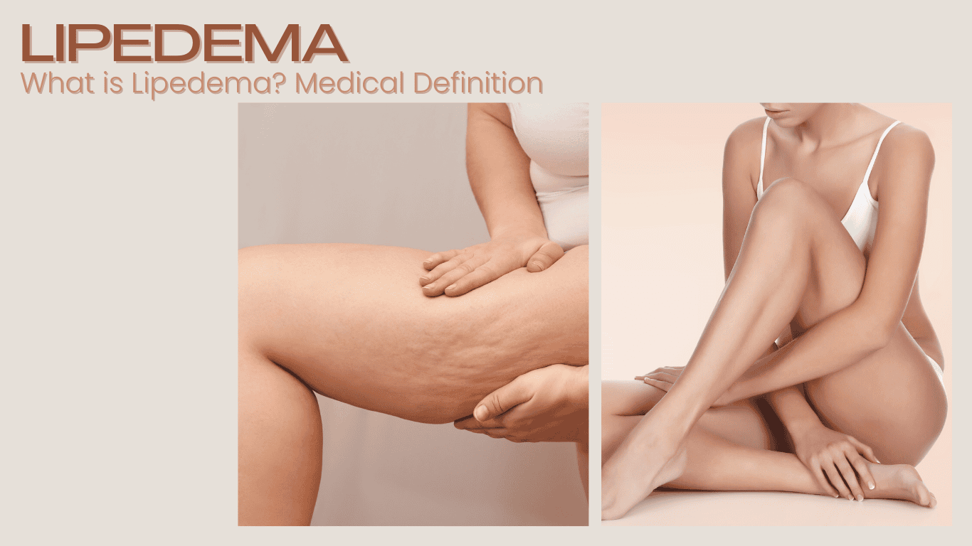 VASER Liposuction for Lipedema Treatment in Turkey